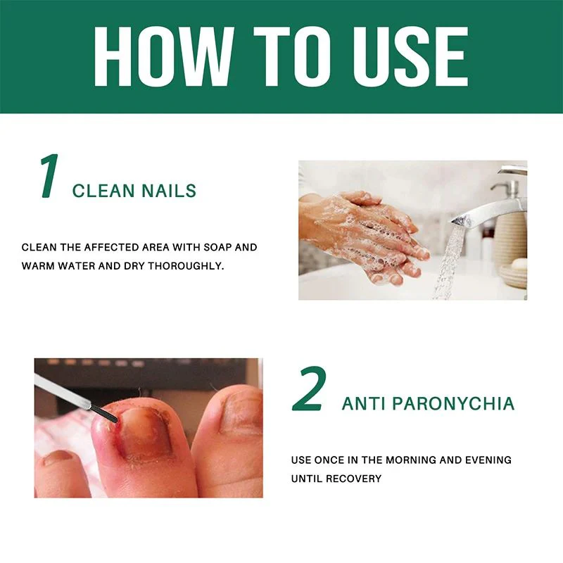 Anti Paronychia Relief Oil – Buy 1 Get 1 FREE 🔥 (முழுமையான நக பராமரிப்பு தீர்வு)