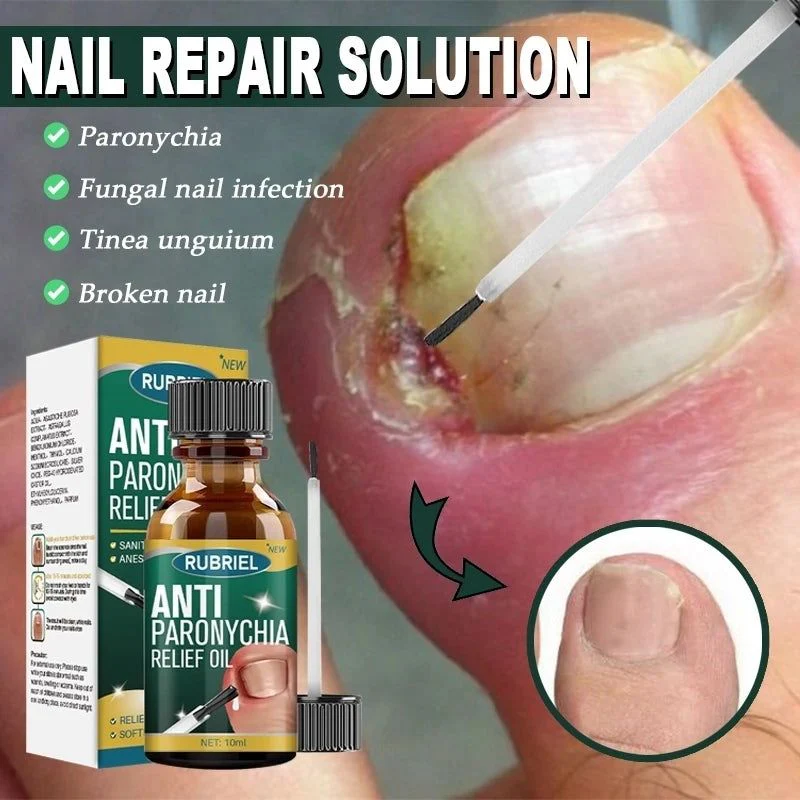 Anti Paronychia Relief Oil – Buy 1 Get 1 FREE 🔥 (முழுமையான நக பராமரிப்பு தீர்வு)