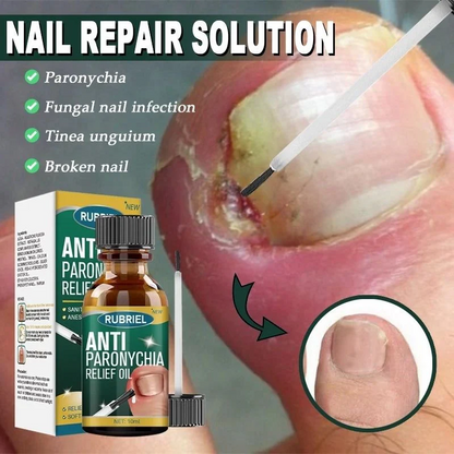 Anti Paronychia Relief Oil – Buy 1 Get 1 FREE 🔥 (முழுமையான நக பராமரிப்பு தீர்வு)